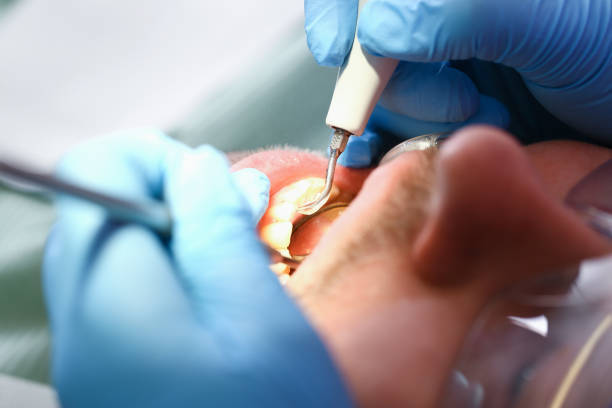 Best Root Canal Emergency Dentist  in Saxapahaw, NC