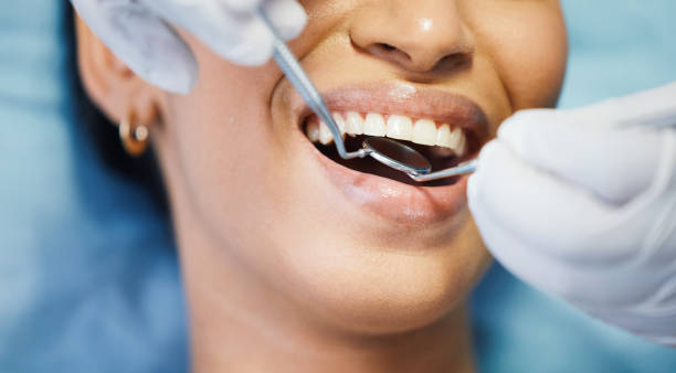 Best Knocked-Out Tooth Emergency  in Saxapahaw, NC