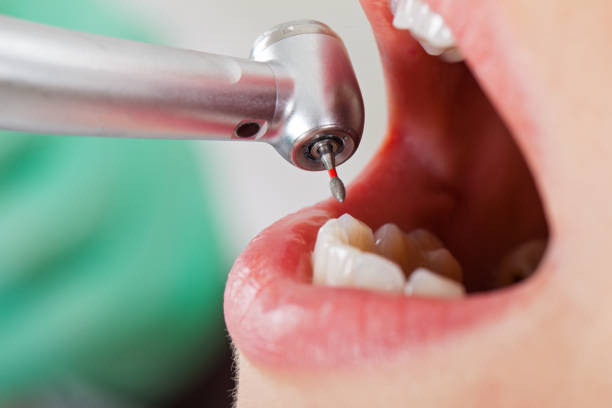 Best Cracked Tooth Emergency Dentist  in Saxapahaw, NC